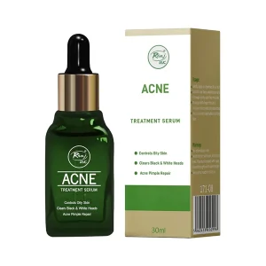 Rivaj UK Acne Treatment Serum 30ml — controls oily skin, clears blackheads whiteheads and acne pimple repair serum in green dropper bottle
